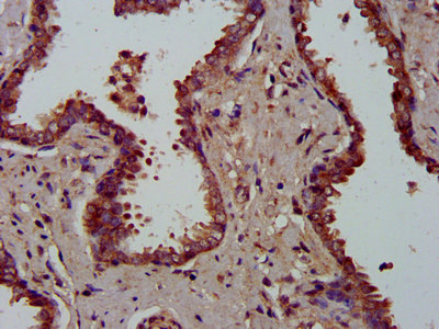 MFAP4 Polyclonal Antibody