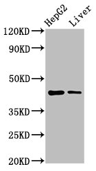 MVD Polyclonal Antibody