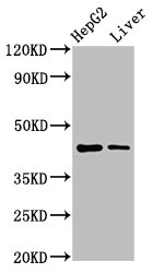 MVD Polyclonal Antibody