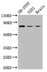 NCDN Polyclonal Antibody
