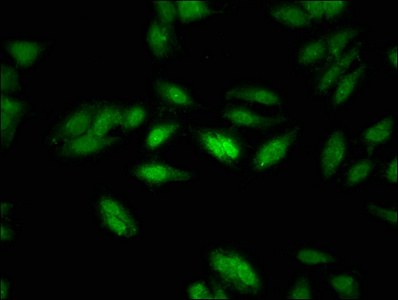 NCOR1 Polyclonal Antibody