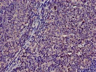Immunohistochemistry of paraffin-embedded human lymph node tissue using TMSB4X Polyclonal Antibody at dilution of 1:100