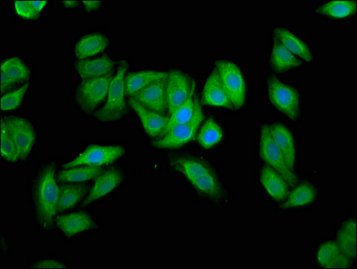 UBIAD1 Polyclonal Antibody