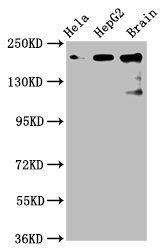 CKAP5 Polyclonal Antibody