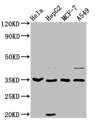 AIMP1 Polyclonal Antibody