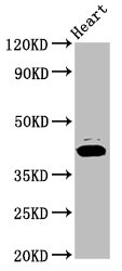 Western Blot<br />Positive WB detected in: Rat heart tissue<br />All lanes: NSDHL antibody at 7.2ug/ml<br />Secondary<br />Goat polyclonal to rabbit IgG at 1/50000 dilution<br />Predicted band size: 42 KDa<br />Observed band size: 42 KDa<br />