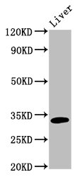 Western Blot<br />Positive WB detected in: Rat liver tissue<br />All lanes: TST antibody at 5ug/ml<br />Secondary<br />Goat polyclonal to rabbit IgG at 1/50000 dilution<br />Predicted band size: 34 KDa<br />Observed band size: 34 KDa<br />