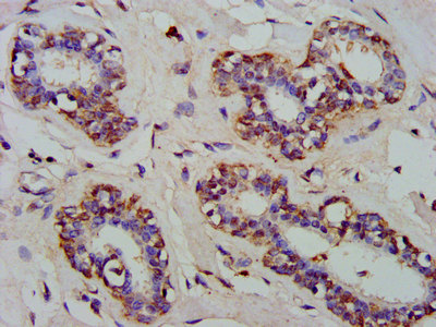 ARFRP1 Polyclonal Antibody