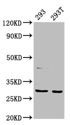 AANAT Polyclonal Antibody (50 µl)