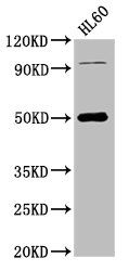 NADK2 Polyclonal Antibody