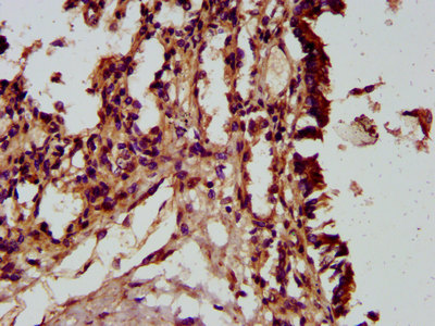 HECTD2 Polyclonal Antibody