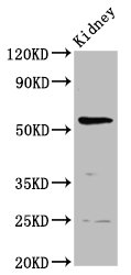 PIGW Polyclonal Antibody
