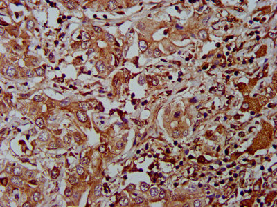 AHNAK2 Polyclonal Antibody