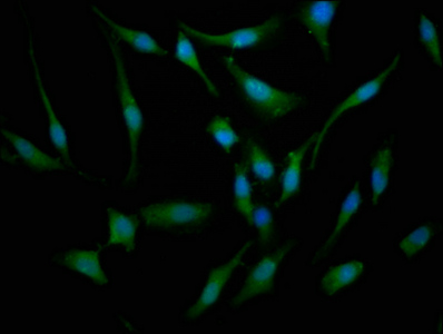 BBS7 Polyclonal Antibody