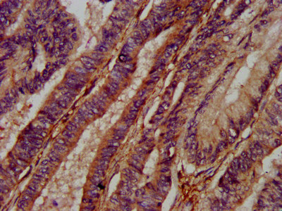 ADAMTS15 Polyclonal Antibody