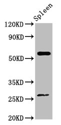 Western Blot<br />Positive WB detected in: Mouse spleen tissue<br />All lanes: ACD antibody at 4ug/ml<br />Secondary<br />Goat polyclonal to rabbit IgG at 1/50000 dilution<br />Predicted band size: 58 KDa<br />Observed band size: 58 KDa<br />