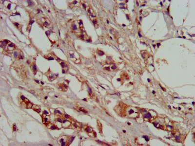 ADO Polyclonal Antibody