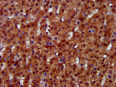 FUK Polyclonal Antibody (50 µl)