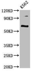 CLPTM1L Polyclonal Antibody