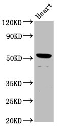 NKD1 Polyclonal Antibody (100 µl)