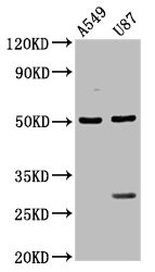 LANCL2 Polyclonal Antibody