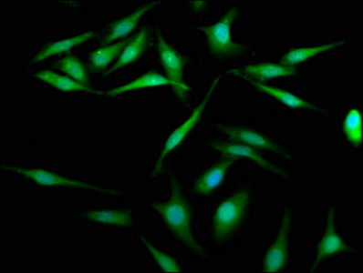 KIFC1 Polyclonal Antibody