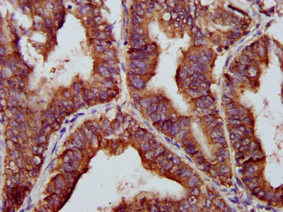 BABAM2 Polyclonal Antibody