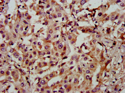 NAA60 Polyclonal Antibody