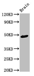 AMBN Polyclonal Antibody