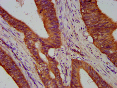 TIMELESS Polyclonal Antibody (100 µl)