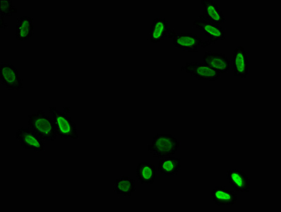 HIST1H3A (K79) Acetyl Polyclonal Antibody