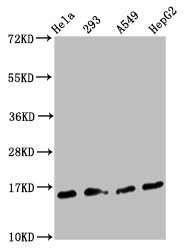 H3F3A (K79) Dimethyl Polyclonal Antibody