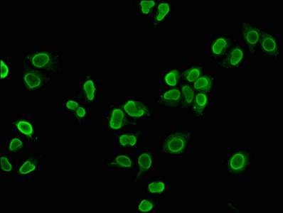 HIST1H4A (Ab-5) Polyclonal Antibody