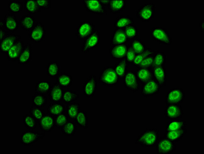 Phospho HIST1H3A (S28) Polyclonal Antibody