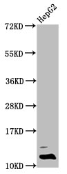 Formyl HIST1H4A (K31) Polyclonal Antibody