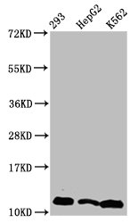 2-hydroxyisobutyryl HIST1H4A (K31) Polyclonal Antibody (100 µl)