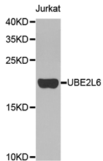 Western blot analysis of extracts of Jurkat cell line, using UBE2L6 Polyclonal Antibody.