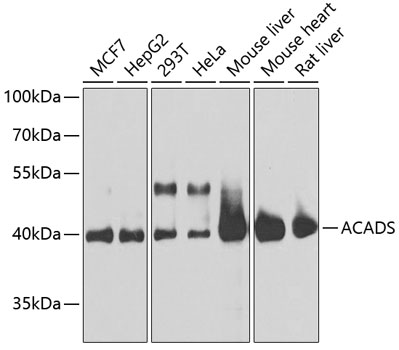 ACADS Polyclonal Antibody&nbsp;<img src="images/icon_newarrival.gif" alt="new" border="0">