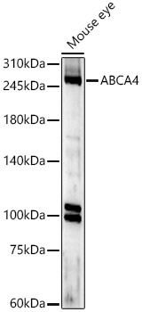 ABCA4 Polyclonal Antibody&nbsp;<img src="images/icon_newarrival.gif" alt="new" border="0">