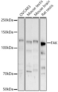 FAK Polyclonal Antibody&nbsp;<img src="images/icon_newarrival.gif" alt="new" border="0">