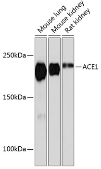 ACE1 Monoclonal Antibody&nbsp;<img src="images/icon_newarrival.gif" alt="new" border="0">