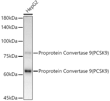 Proprotein Convertase 9(PCSK9) Monoclonal Antibody&nbsp;<img src="images/icon_newarrival.gif" alt="new" border="0">