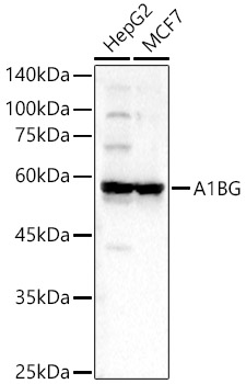 A1BG Polyclonal Antibody&nbsp;<img src="images/icon_newarrival.gif" alt="new" border="0">