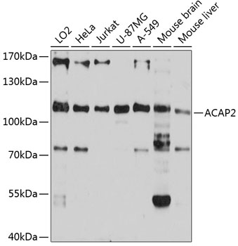ACAP2 Polyclonal Antibody&nbsp;<img src="images/icon_newarrival.gif" alt="new" border="0">