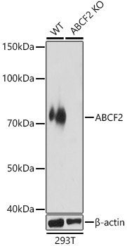 ABCF2 Polyclonal Antibody&nbsp;<img src="images/icon_newarrival.gif" alt="new" border="0">