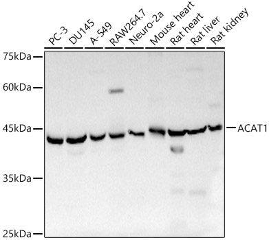 ACAT1 Polyclonal Antibody&nbsp;<img src="images/icon_newarrival.gif" alt="new" border="0">