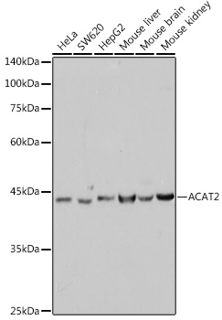 ACAT2 Monoclonal Antibody&nbsp;<img src="images/icon_newarrival.gif" alt="new" border="0">