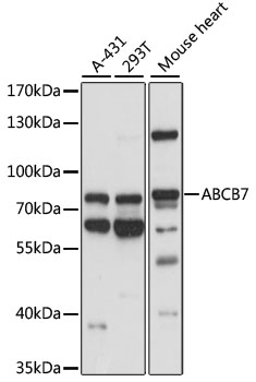 ABCB7 Polyclonal Antibody&nbsp;<img src="images/icon_newarrival.gif" alt="new" border="0">