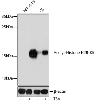 Acetyl-Histone H2B-K5 Polyclonal Antibody&nbsp;<img src="images/icon_newarrival.gif" alt="new" border="0">