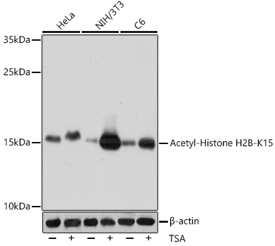 Acetyl-Histone H2B-K15 Polyclonal Antibody&nbsp;<img src="images/icon_newarrival.gif" alt="new" border="0">